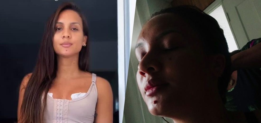 Maxiane revela reação alérgica e desafios pós-mastopexia enquanto cuida do filho autista