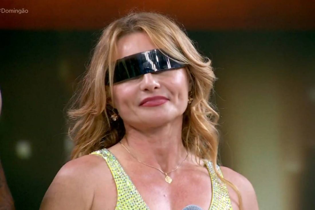 Rita Guedes revela risco de perder a visão após blefaroplastia; entenda as complicações da cirurgia