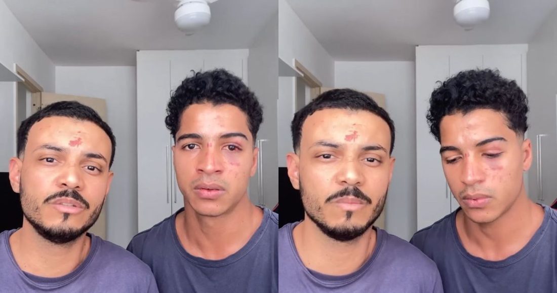 Jovens são agredidos com insultos homofóbicos após festa universitária no Rio de Janeiro