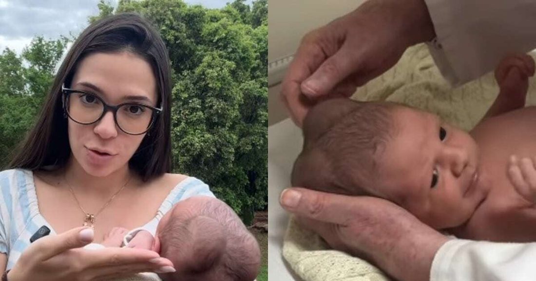 Influencer Daiane esclarece origem dos dois calombos na cabeça do bebê João