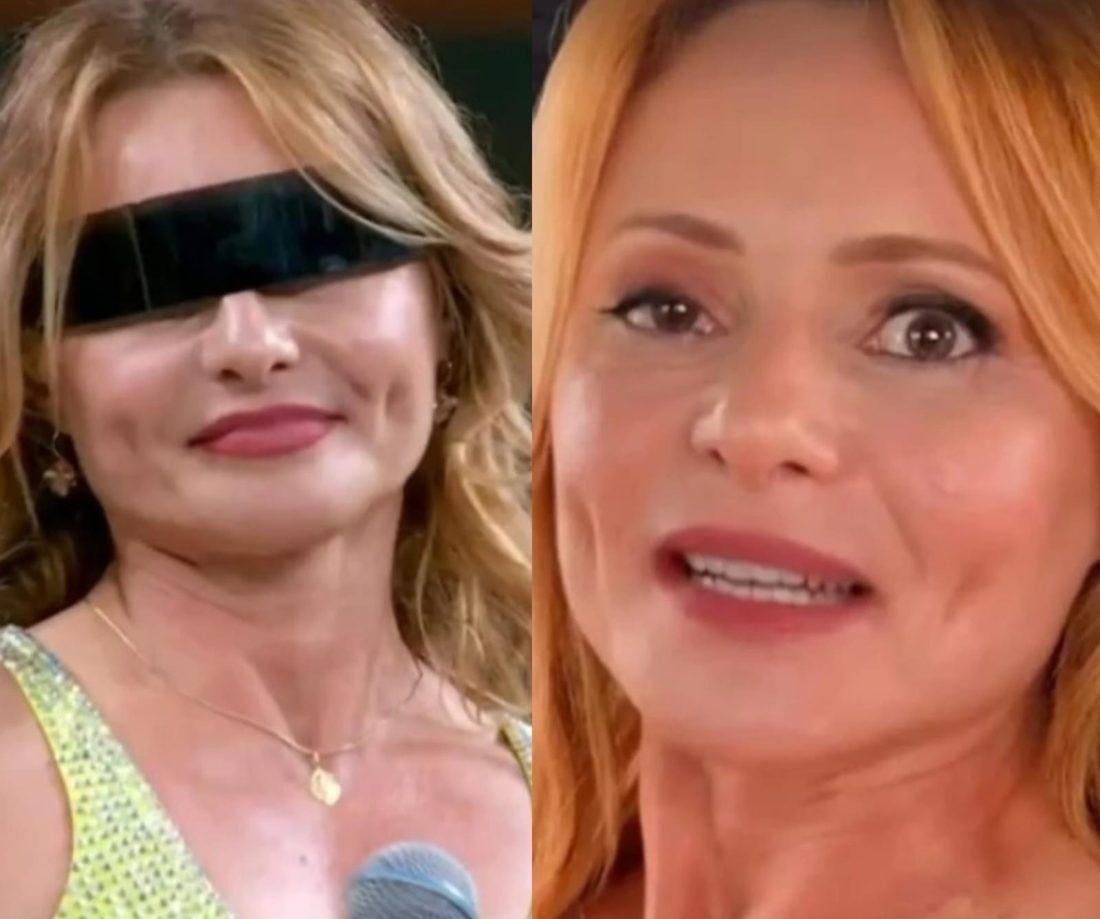 Rita Guedes relata desafio em "Dança dos Famosos" e recuperação após complicações de blefaroplastia
