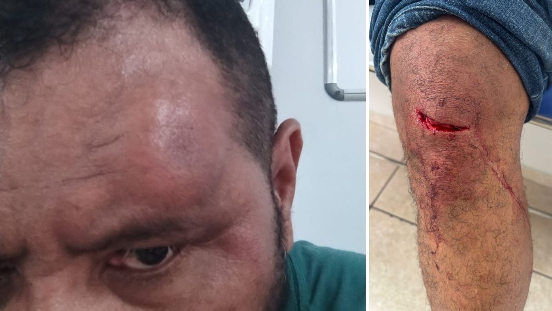 Justiça condena três réus por agressão a Oficial de Justiça em Hortolândia