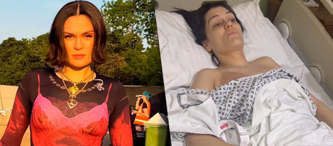 Por que Jessie J precisou de duas cirurgias de reconstrução mamária? Especialista explica