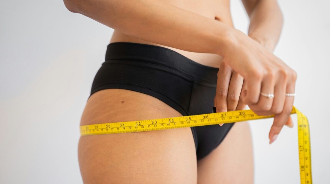 Lipedema e emagrecimento: por que a balança baixa e as medidas das pernas permanecem iguais