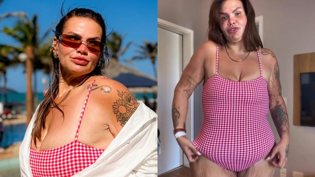 Thais Carla afirma não sentir incômodo com excesso de pele após perder 120 kg
