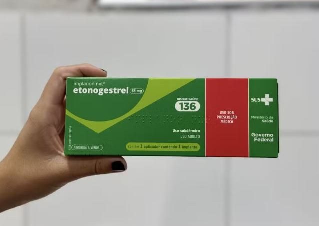 Anvisa amplia eficácia do Implanon NXT de três para cinco anos e autoriza inserção pós-parto e pós-aborto